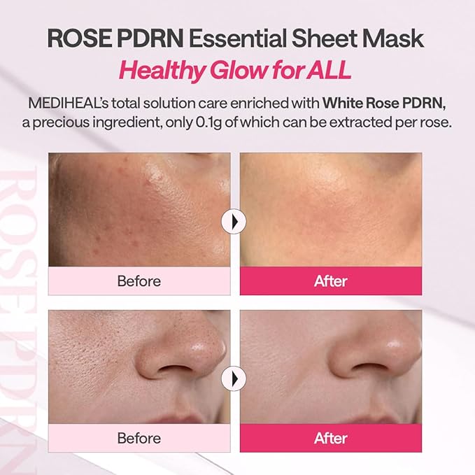 ROSE PDRN ESSENTIAL MASK – HEALTHY GLOW