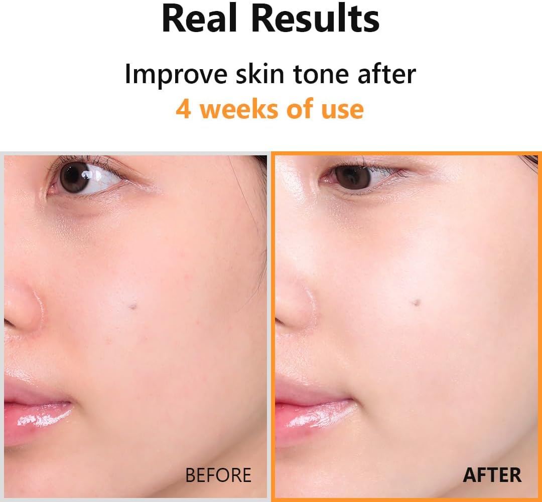 HYPER VITAMIN C 23 SERUM (20ml)