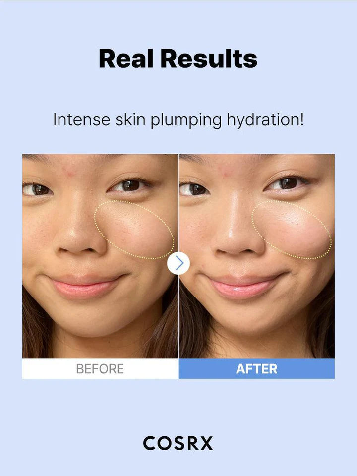 THE HYALURONIC ACID 3 SERUM (20ml)