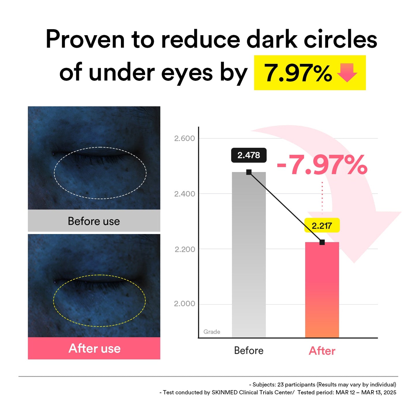 Abib PDRN Retinal Eye Patch clinical result graphic showing reduced appearance of under-eye dark circles by 7.97 percent.