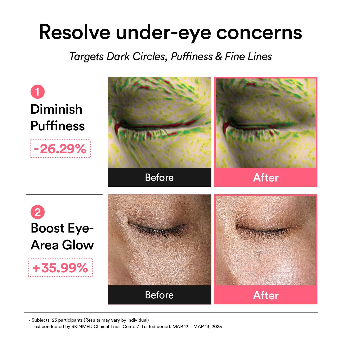 Abib PDRN Retinal Eye Patch before and after results graphic for diminished puffiness and boosted eye-area glow.