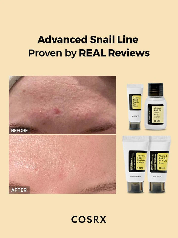 Before and after results using COSRX snail kit – smoother skin, reduced redness, improved texture