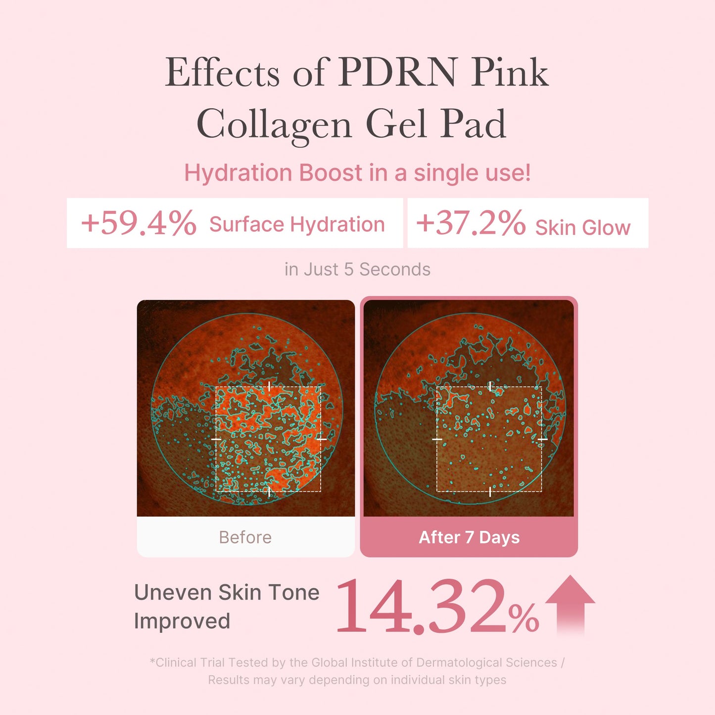 Medicube PDRN Pink Collagen Gel Pad — Korean toner pads for hydration boost, skin glow and uneven skin tone care.